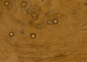 Pythium oospores